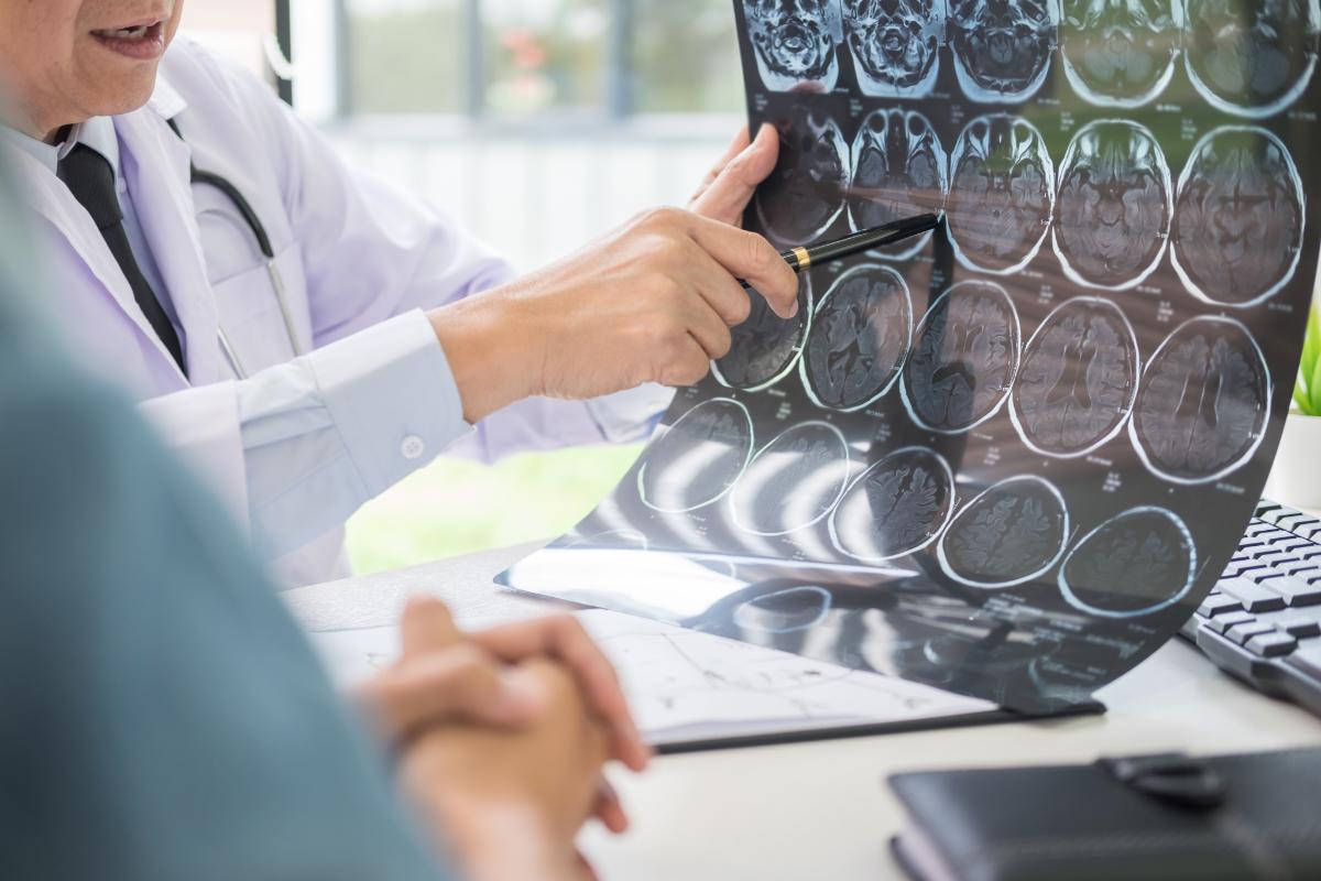 Doctor showing how schizophrenia affects the brain